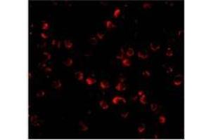 Immunofluorescence of ARF-BP1 in Daudi cells with AP30078PU-N ARF-BP1 antibody at 20 μg/ml. (HUWE1 antibody  (C-Term))