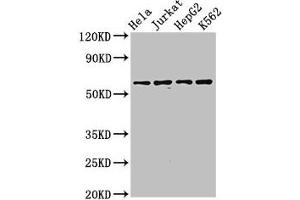 Western Blot Positive WB detected in: Hela whole cell lysate, Jurkat whole cell lysate, HepG2 whole cell lysate, K562 whole cell lysate All lanes: SMARCD1 antibody at 3. (SMARCD1 antibody  (AA 7-124))