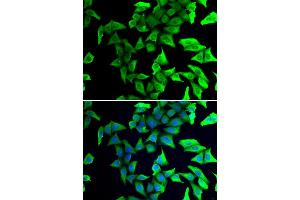 Immunofluorescence analysis of U2OS cells using VSNL1 antibody. (VSNL1 antibody)