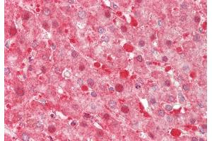 Rabbit Anti-TXN2 antibody Catalog Number: ARP54910 Formalin Fixed Paraffin Embedded Tissue: Human Liver Primary antibody Concentration: 1:200 Secondary Antibody: Donkey anti-Rabbit-Cy3 Secondary Antibody Concentration: 1:200 Magnification: 20x Exposure Time: 0. (TXN2 antibody  (Middle Region))