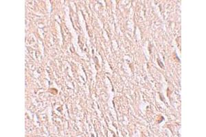 Immunohistochemistry (IHC) image for anti-Leucine Rich Repeat Transmembrane Neuronal 3 (LRRTM3) (C-Term) antibody (ABIN1030498) (LRRTM3 antibody  (C-Term))