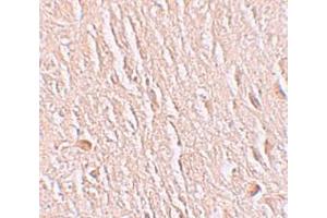 Immunohistochemistry (IHC) image for anti-Leucine Rich Repeat Transmembrane Neuronal 3 (LRRTM3) (C-Term) antibody (ABIN1030498) (LRRTM3 antibody  (C-Term))