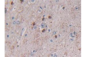 Detection of BECN1 in Human Cerebrum Tissue using Polyclonal Antibody to Beclin 1 (BECN1) (Beclin 1 antibody  (AA 1-273))