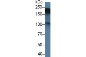 Rabbit Capture antibody from the kit in WB with Positive Control:  Rat Placenta lysate.