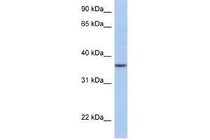 LFNG antibody used at 1 ug/ml to detect target protein.
