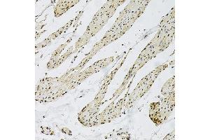 Immunohistochemistry of paraffin-embedded human smooth muscle using CD9 Rabbit pAb  at dilution of 1:100 (40x lens). (CD9 antibody  (AA 112-195))
