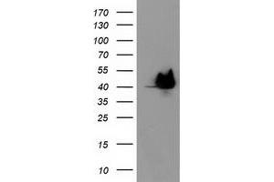 HEK293T cells were transfected with the pCMV6-ENTRY control (Left lane) or pCMV6-ENTRY HSPBP1 (Right lane) cDNA for 48 hrs and lysed. (HSPBP1 antibody)