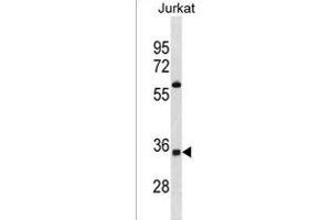 OR52A5 Antibody (C-term) (ABIN1881604 and ABIN2838603) western blot analysis in Jurkat cell line lysates (35 μg/lane).