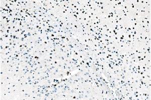 IHC analysis of ADAR1/ADAR using anti-ADAR1/ADAR antibody (ABIN7598956).