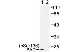 Image no. 1 for anti-BCL2-Associated Agonist of Cell Death (BAD) (pSer136), (pSer99) antibody (ABIN317969) (BAD antibody  (pSer99, pSer136))
