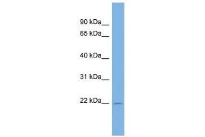 C13ORF28 antibody used at 1 ug/ml to detect target protein. (SPACA7 antibody  (Middle Region))