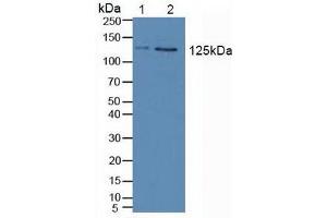 Figure. (JAK2 antibody  (AA 508-800))