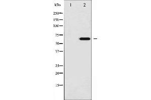 Western blot analysis of Ezrin phosphorylation expression in UV treated 293 whole cell lysates,The lane on the left is treated with the antigen-specific peptide. (Ezrin antibody  (pTyr146))