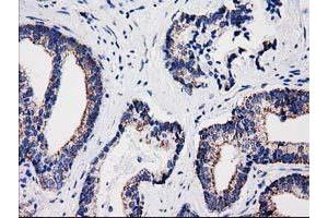 Image no. 1 for anti-Sulfotransferase Family, Cytosolic, 1A, Phenol-Preferring, Member 1 (SULT1A1) antibody (ABIN1501226) (SULT1A1 antibody)