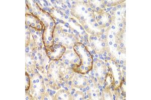 Immunohistochemistry of paraffin-embedded rat kidney using CLDN1 antibody (ABIN5971222) at dilution of 1/100 (40x lens).