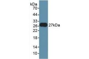 Detection of Recombinant FGF21, Rat using Polyclonal Antibody to Fibroblast Growth Factor 21 (FGF21) (FGF21 antibody  (AA 25-208))