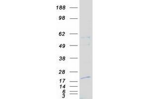 Validation with Western Blot (NXT1 Protein (Myc-DYKDDDDK Tag))