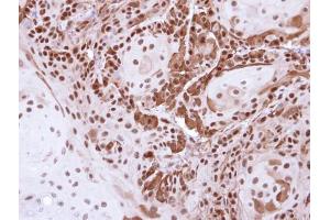 IHC-P Image Immunohistochemical analysis of paraffin-embedded Cal27 Xenograft , using DDB1, antibody at 1:500 dilution. (DDB1 antibody  (C-Term))