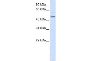 RGS11 antibody used at 1 ug/ml to detect target protein.