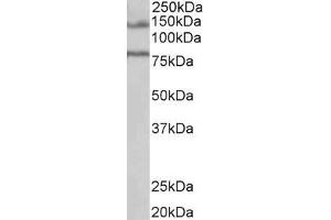 ABIN238631 (1µg/ml) staining of Human Brain (Hippocampus) lysate (35µg protein in RIPA buffer). (EPB41L5 antibody  (Internal Region))