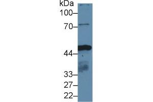 Detection of IDH1 in Human HepG2 cell lysate using Polyclonal Antibody to Isocitrate Dehydrogenase 1, Soluble (IDH1) (IDH1 antibody  (AA 74-333))