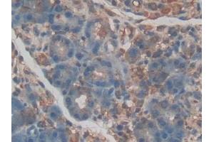 Detection of EPCR in Rat Pancreas Tissue using Polyclonal Antibody to Endothelial protein C receptor (EPCR) (PROCR antibody  (AA 59-217))