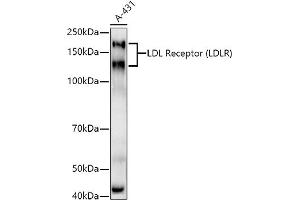 Western blot analysis of extracts of A-431 cells, using LDL Receptor (LDLR) antibody  at 1:1000 dilution. (LDLR antibody)