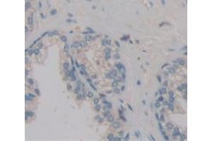 IHC-P analysis of Kidney tissue, with DAB staining. (POTEG antibody  (AA 177-330))