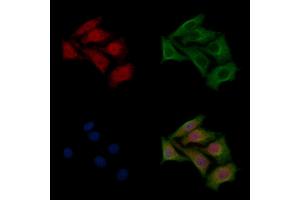 ABIN6261318 and ABIN6266877 staining HepG2 cells by IF/ICC. (DMPK antibody  (N-Term))