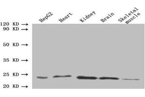 Western blot All lanes: ORM2 antibody at 1. (Orosomucoid 2 antibody  (AA 19-201))