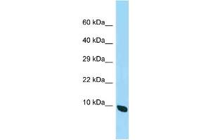 WB Suggested Anti-2410015M20Rik Antibody Titration: 1. (Chromosome 19 Open Reading Frame 70 (C19ORF70) (C-Term) antibody)