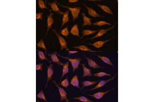 Immunofluorescence analysis of L929 cells using  antibody (ABIN7265416) at dilution of 1:100. (ACBD3 antibody  (AA 1-160))