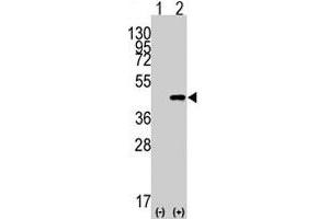 Western blot analysis of CDX2 (arrow) using rabbit CDX2 polyclonal antibody  . (CDX2 antibody  (N-Term))
