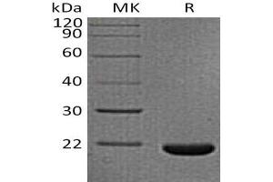 Western Blotting (WB) image for Interleukin 33 (IL33) protein (His tag) (ABIN7320998) (IL-33 Protein (His tag))