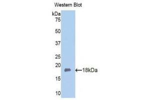 Western Blotting (WB) image for anti-Fibulin 5 (FBLN5) (AA 327-448) antibody (ABIN1176018) (Fibulin 5 antibody  (AA 327-448))