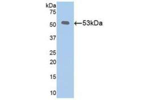 WB of Protein Standard: different control antibodies  against Highly purified E. (Klotho ELISA Kit)