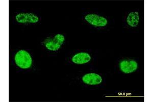 Immunofluorescence of monoclonal antibody to HOXA5 on HeLa cell. (HOXA5 antibody  (AA 171-270))