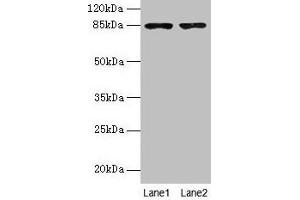 Western blot All lanes: FCHSD2 antibody at 12 μg/mL Lane 1: U251 whole cell lysate Lane 2: A549 whole cell lysate Secondary Goat polyclonal to rabbit IgG at 1/10000 dilution Predicted band size: 85, 78, 59 kDa Observed band size: 85 kDa