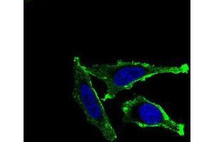 Immunofluorescence analysis of Hela cells using ITGAM mouse mAb (green). (CD11b antibody  (AA 623-728))