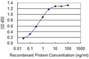 Detection limit for recombinant GST tagged S100B is 0. (S100B antibody  (AA 1-92))