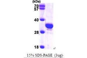SDS-PAGE (SDS) image for Secretagogin, EF-Hand Calcium Binding Protein (SCGN) (AA 1-276) protein (His tag) (ABIN667217)