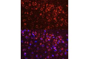 Immunofluorescence analysis of mouse brain using YB-1/YB-1/YBX1 antibody (ABIN6134494, ABIN6150328, ABIN6150330 and ABIN7101815) at dilution of 1:100.