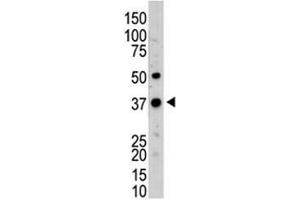 Western blot testing of UCH37 antibody and mouse kidney tissue lysate (UCHL5 antibody  (AA 56-87))