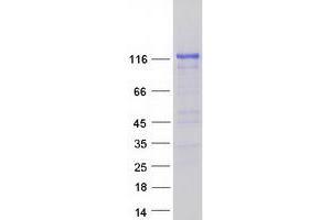 Validation with Western Blot (SYNPO Protein (Transcript Variant 3) (Myc-DYKDDDDK Tag))