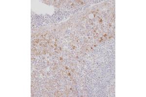 Immunohistochemical analysis of B on paraffin-embedded Human tonsil tissue. (CSF1R antibody  (C-Term))