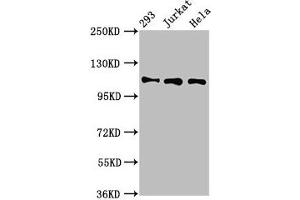 Western Blot Positive WB detected in: 293 whole cell lysate, Jurkat whole cell lysate, Hela whole cell lysate All lanes: RAB3GAP1 antibody at 7 μg/mL Secondary Goat polyclonal to rabbit IgG at 1/50000 dilution Predicted band size: 111, 112, 106 kDa Observed band size: 111 kDa (RAB3GAP1 antibody  (Catalytic Subunit))