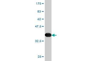 Western Blot detection against Immunogen (36. (Peroxiredoxin 4 antibody  (AA 51-150))