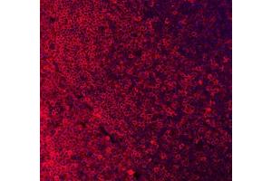 IF analysis of CD79A using anti-CD79A antibody (ABIN3043397).