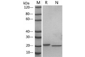 2 μg of LIF, Mouse was resolved with SDS-PAGE under reducing (R) and non-reducing (N) conditions and visualized by Coomassie Blue staining. (LIF Protein (AA 24-203))