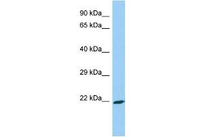 Host: Rabbit Target Name: ASB18 Sample Type: Fetal Liver lysates Antibody Dilution: 1.